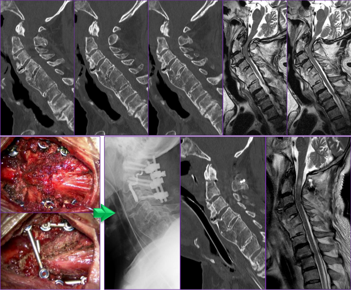脊椎脊髄外傷 | 町田の脳神経外科・脊髄外科・神経内科「町田脳神経外科」